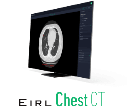EIRL Chest CT