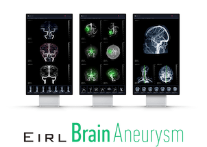 EIRL Brain Aneurysm