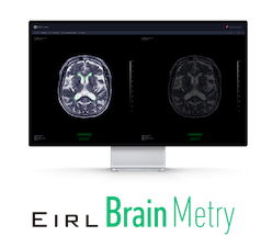 EIRL Brain Metry