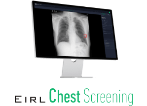 EIRL Chest Screening