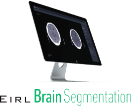 EIRL Brain Brainsegmentation