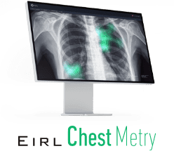 EIRL Chest Metry